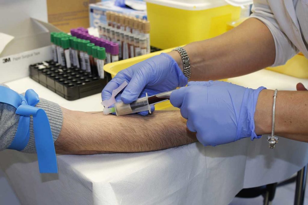 Vial of blood being drawn for clinical trial and drug efficacy